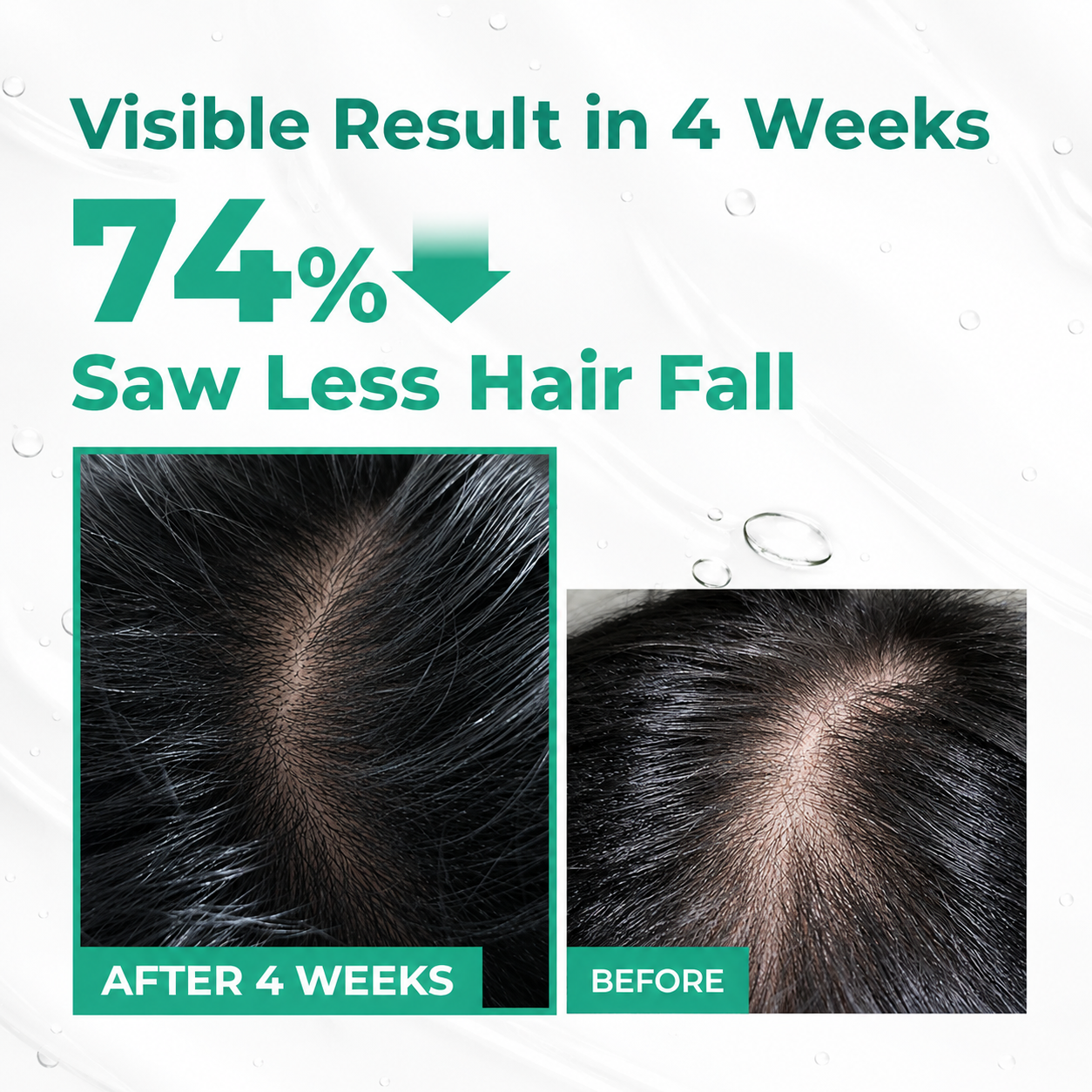 Scalp Boosting Hair Serum